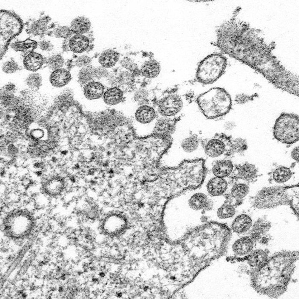Sars-CoV-2 a suferit mutații, a dezvoltat o nouă tulpină și este mai infecțios