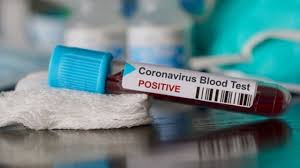 Un bărbat din Anglia a murit de coronavirus pe 30 ianuarie, cu trei zile înainte ca virusul să fie recunoscut oficial