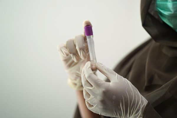 Grecia confirmă un prim caz de variola maimuței la un român din Marea Britanie